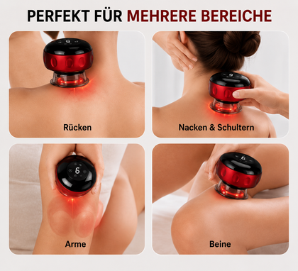 Novora™ Smart Electric Cupping Massager image 7